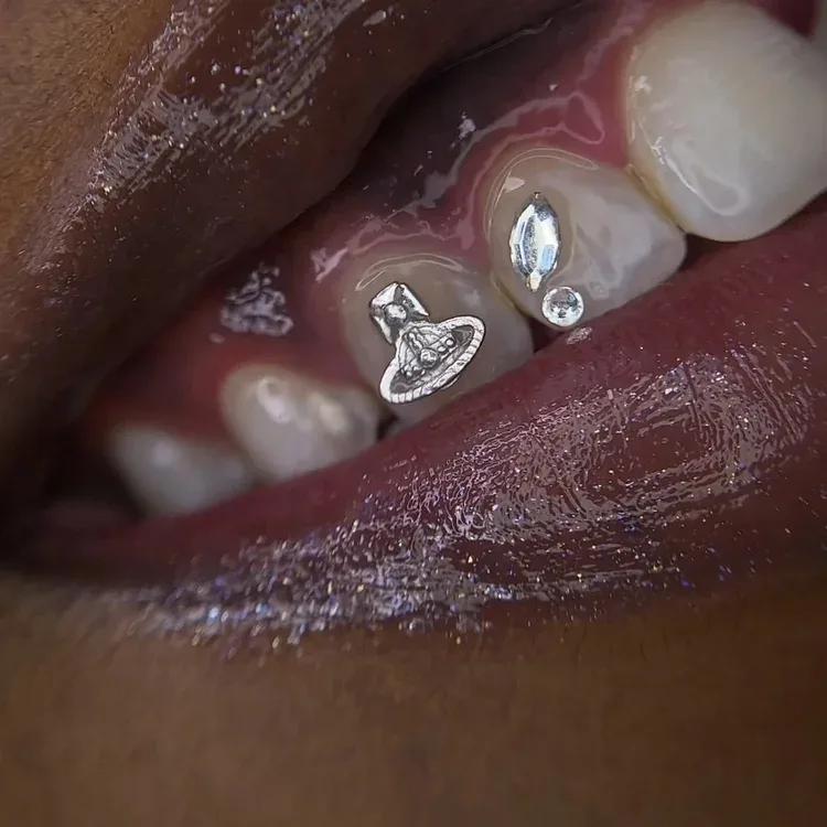 Tooth gems — Westwood orb crystal and accent gems on teeth with glossy lips